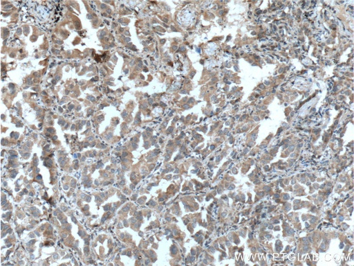 [12529-1-AP-20UL] PLAA Polyclonal antibody