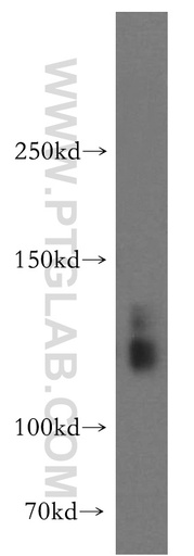 [12531-1-AP-150UL] SLC4A8 Polyclonal antibody