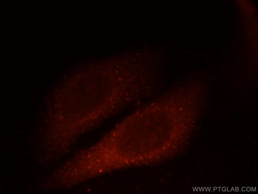 [12532-1-AP-20UL] GAGE2D Polyclonal antibody