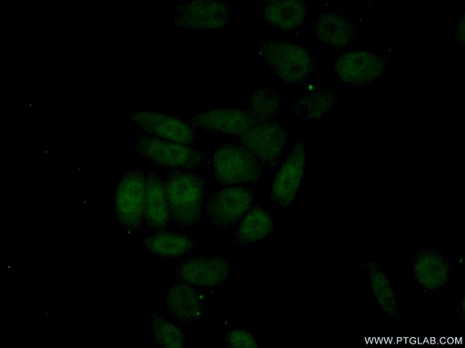 [12533-1-AP-150UL] HNF1B Polyclonal antibody