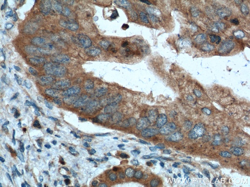 [12540-1-AP-150UL] Amylase Alpha Polyclonal antibody