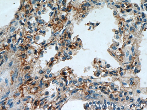[12541-1-AP-150UL] PIP5K1B Polyclonal antibody
