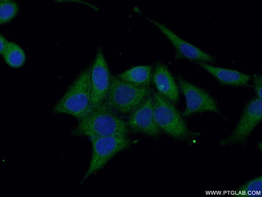 [12542-1-AP-150UL] Annexin VI Polyclonal antibody