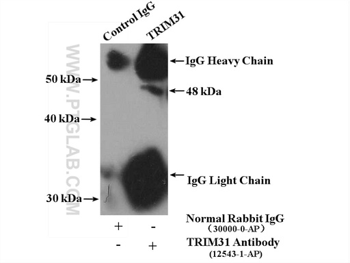 [12543-1-AP-20UL] TRIM31 Polyclonal antibody