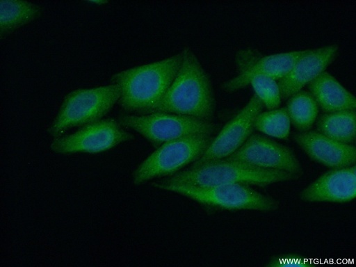 [12548-1-AP-150UL] CPVL Polyclonal antibody