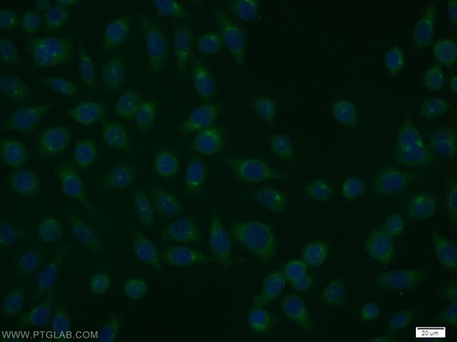 [12549-1-AP-150UL] RGS17 Polyclonal antibody