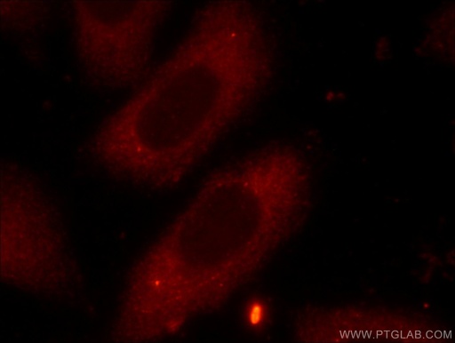 [12552-1-AP-20UL] FXR2 Polyclonal antibody