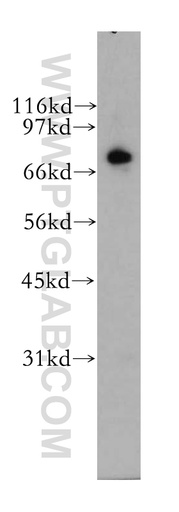[12556-1-AP-150UL] RAPGEF5 Polyclonal antibody