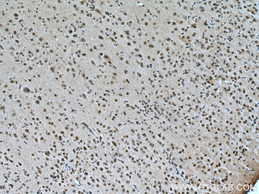 [12557-1-AP-150UL] PRMT8 Polyclonal antibody