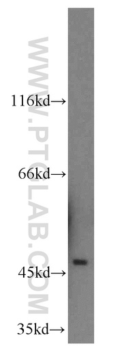 [12558-1-AP-20UL] Neuroserpin Polyclonal antibody