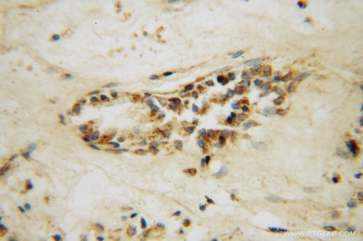 [12559-1-AP-150UL] STK36 Polyclonal antibody