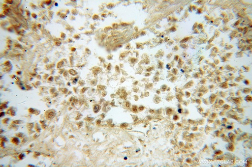 [12560-1-AP-20UL] FUT8 Polyclonal antibody