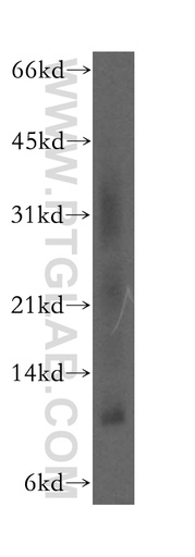 [12561-1-AP-20UL] SELK Polyclonal antibody