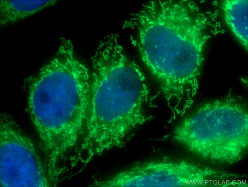 [12562-1-AP-20UL] AK3 Polyclonal antibody