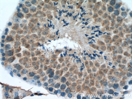 [12565-1-AP-150UL] ROPN1L Polyclonal antibody