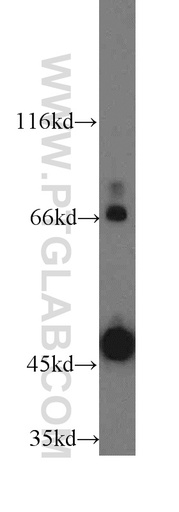 [12566-1-AP-150UL] CD84 Polyclonal antibody