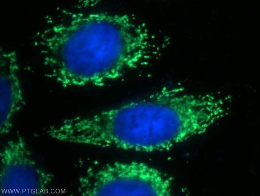 [12568-1-AP-150UL] AMPK Gamma 2 Polyclonal antibody