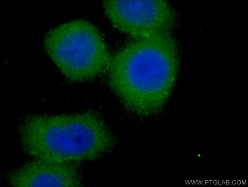 [12569-1-AP-150UL] SCFD1 Polyclonal antibody