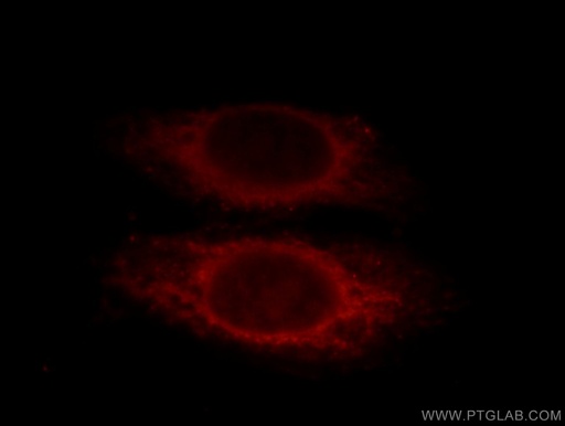 [12570-1-AP-20UL] SMAD2 Polyclonal antibody