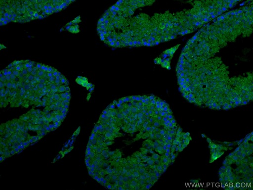 [12572-1-AP-150UL] EPAC1 Polyclonal antibody