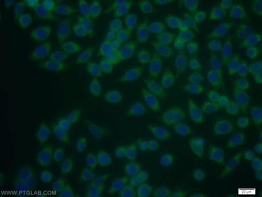[12574-1-AP-20UL] TSP50 Polyclonal antibody
