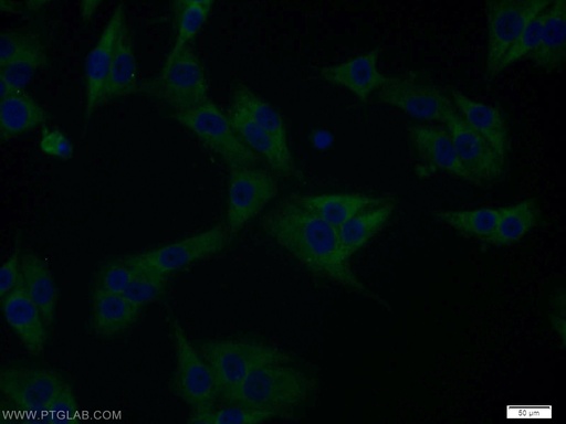 [12575-1-AP-150UL] PTTG1IP Polyclonal antibody