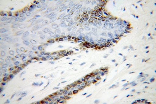[12581-1-AP-20UL] UBE2Q2 Polyclonal antibody