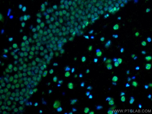 [12582-1-AP-150UL] PTBP1 Polyclonal antibody