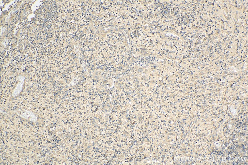 [12583-1-AP-150UL] ARHGAP29 Polyclonal antibody