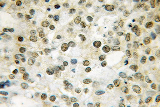 [12584-1-AP-150UL] THAP1 Polyclonal antibody