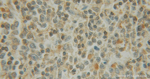 [12585-1-AP-150UL] EXOSC1 Polyclonal antibody