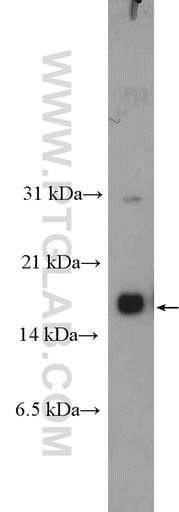 [12588-1-AP-150UL] CRABP1 Polyclonal antibody