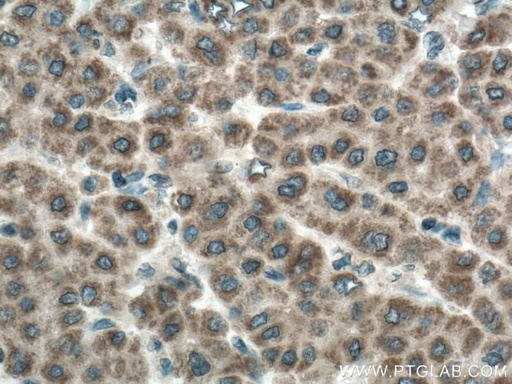 [12589-1-AP-150UL] CDO1 Polyclonal antibody
