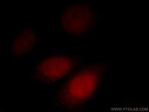[12591-1-AP-20UL] AKAP7 Polyclonal antibody