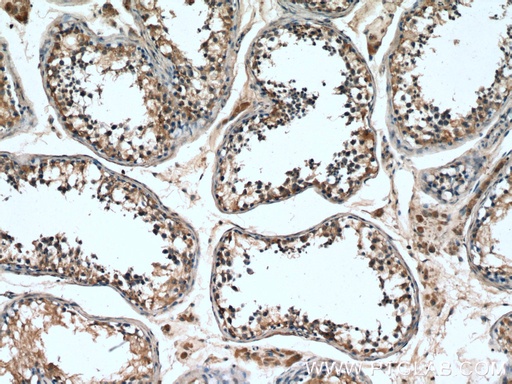 [12593-1-AP-150UL] TSGA10 Polyclonal antibody