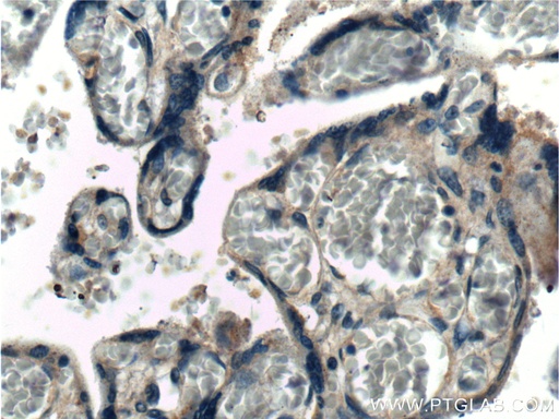 [12594-1-AP-20UL] Integrin Beta 1 Polyclonal antibody
