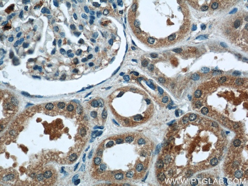 [12595-1-AP-20UL] PANX1 Polyclonal antibody