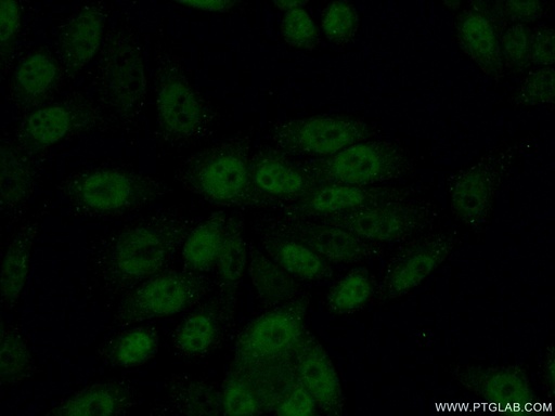 [12597-1-AP-150UL] GABPB1 Polyclonal antibody