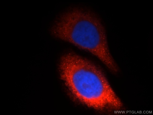 [12599-1-AP-20UL] CTBS Polyclonal antibody