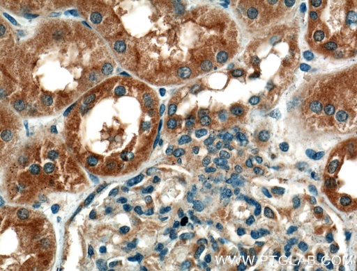 [12601-1-AP-150UL] GCLC Polyclonal antibody