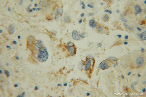 [12602-1-AP-150UL] MAOB Polyclonal antibody