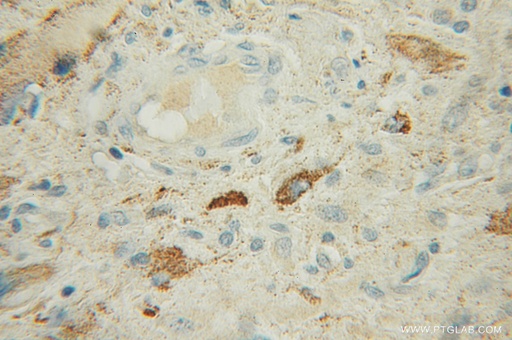 [12603-1-AP-150UL] IPPK Polyclonal antibody