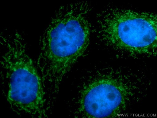 [12604-1-AP-150UL] IFIT2 Polyclonal antibody