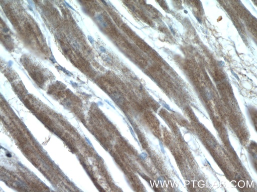 [12605-1-AP-150UL] GUCY1A3 Polyclonal antibody