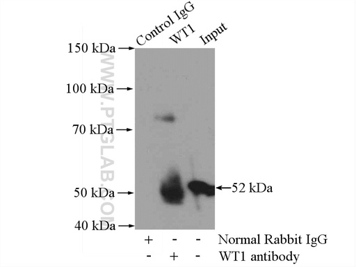 [12609-1-AP-150UL] WT1 Polyclonal antibody