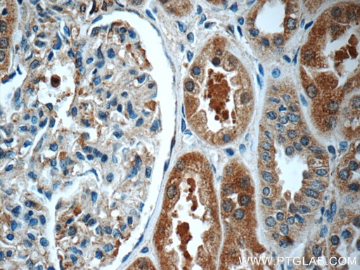 [12611-1-AP-20UL] ECOP Polyclonal antibody