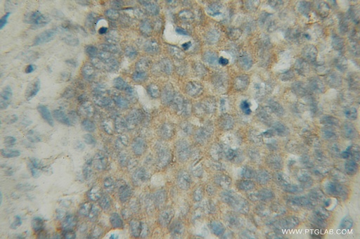 [12612-1-AP-150UL] PIGB Polyclonal antibody