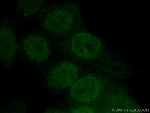 [12613-1-AP-150UL] HOXB7 Polyclonal antibody