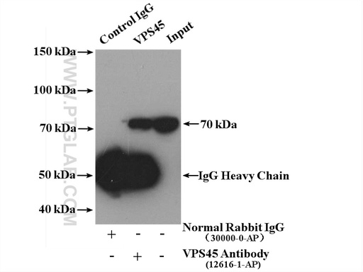[12616-1-AP-150UL] VPS45 Polyclonal antibody