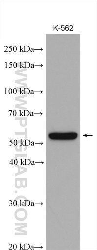 [12619-1-AP-20UL] MICA Polyclonal antibody